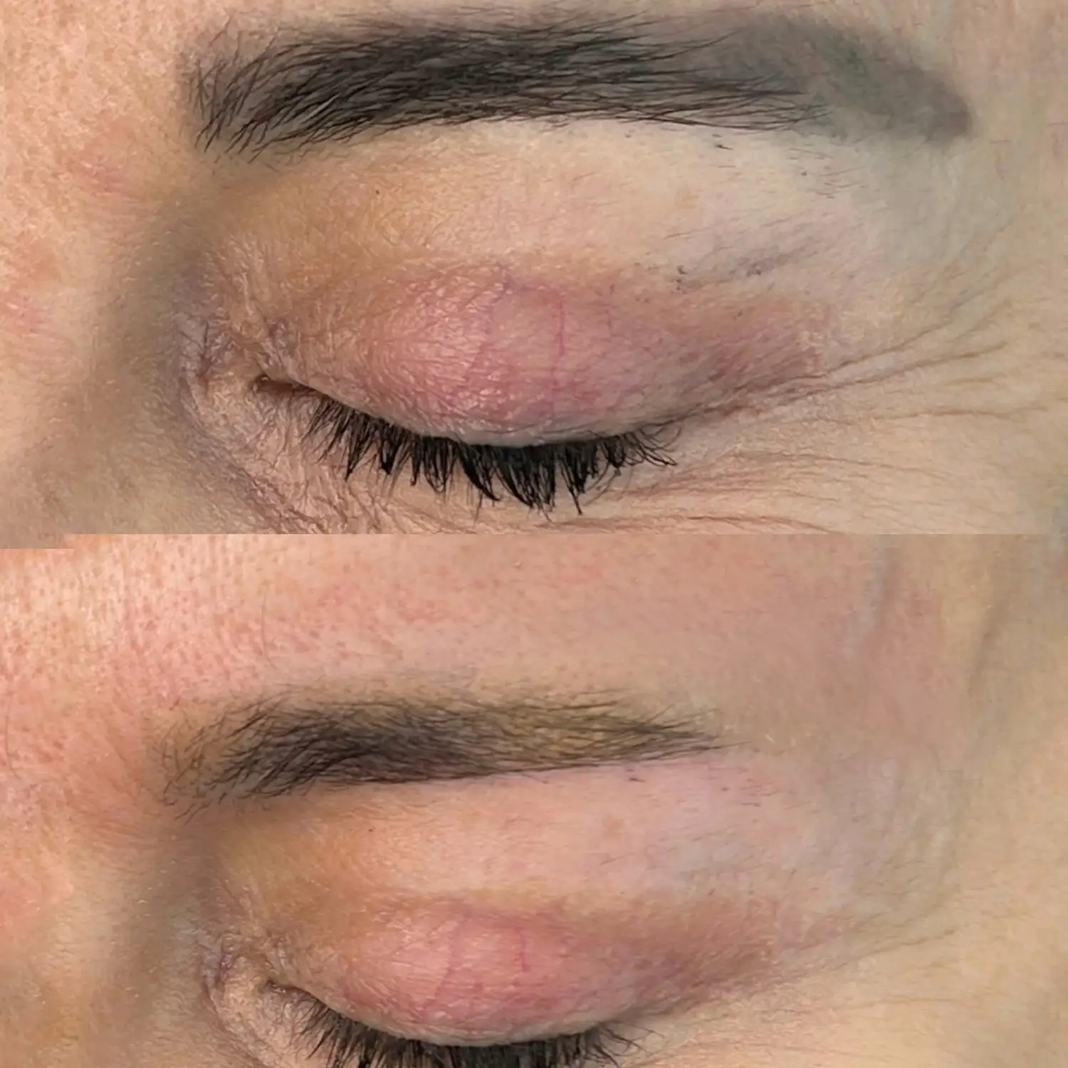 Sandra Sánchez especialista en despigmentación láser en Madrid